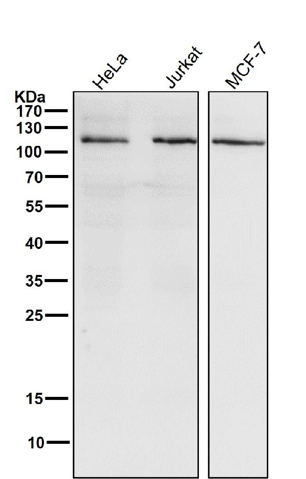 WB - Anti-PI 3 kinase p110 alpha Monoclonal Antibody ABO14359